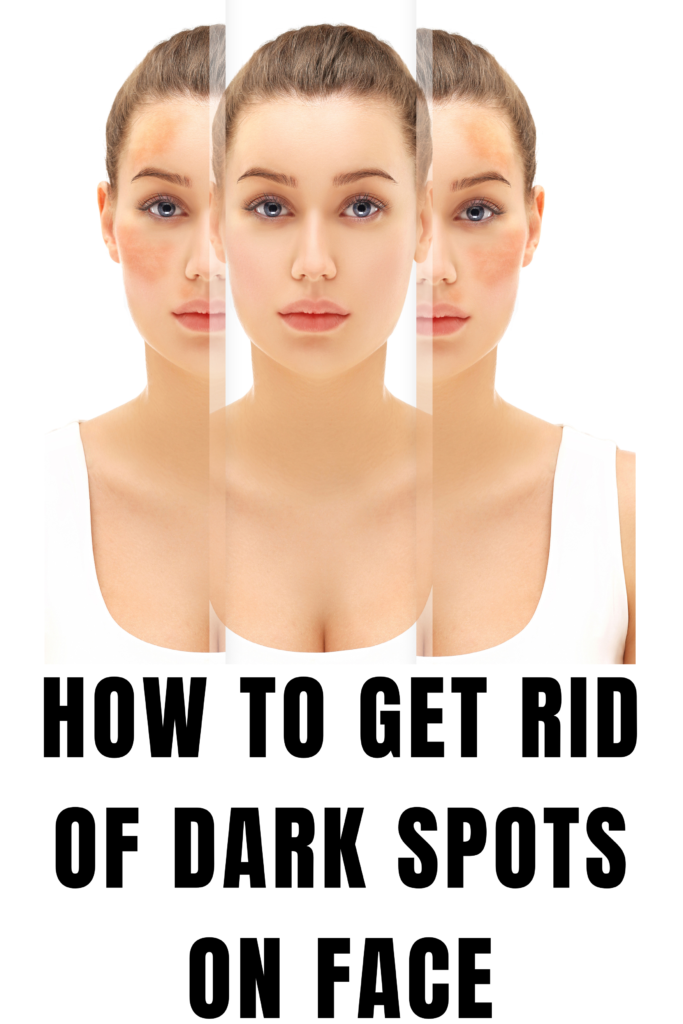 How to Get Rid of Dark Spots on Face