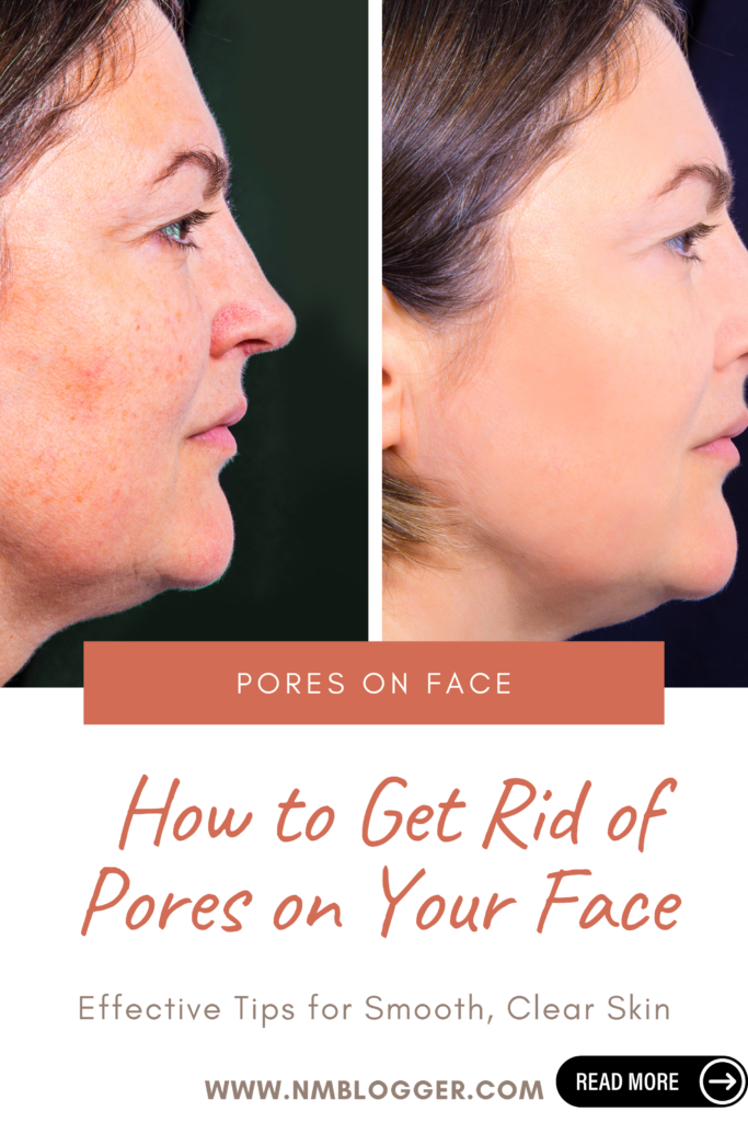 How to Get Rid of Pores on Your Face