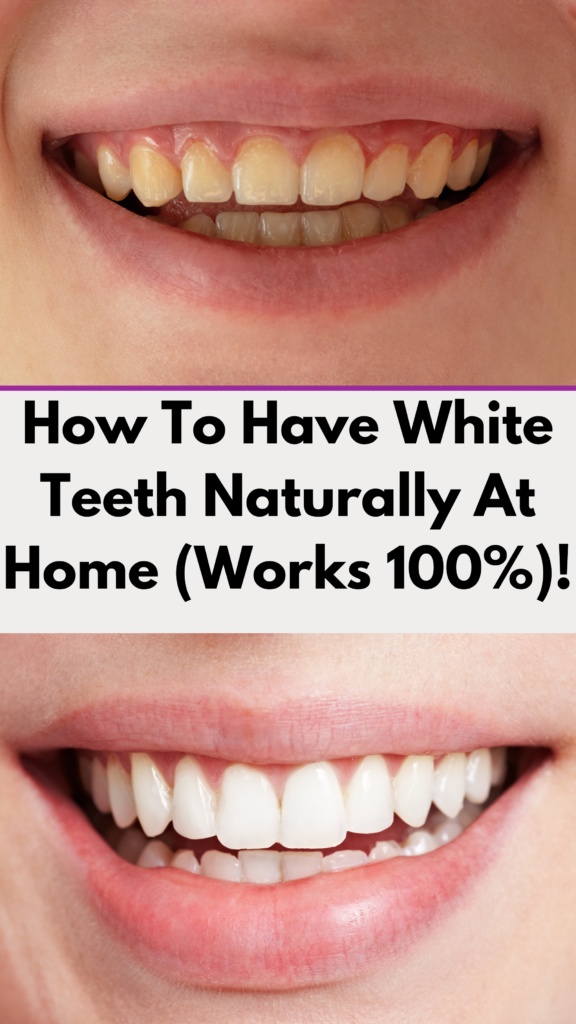 How To Have White Teeth Naturally At Home (Works 100%)!